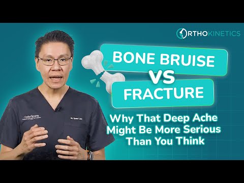 Bone Bruise vs. Fracture: Why That Deep Ache Might Be More Serious Than You Think