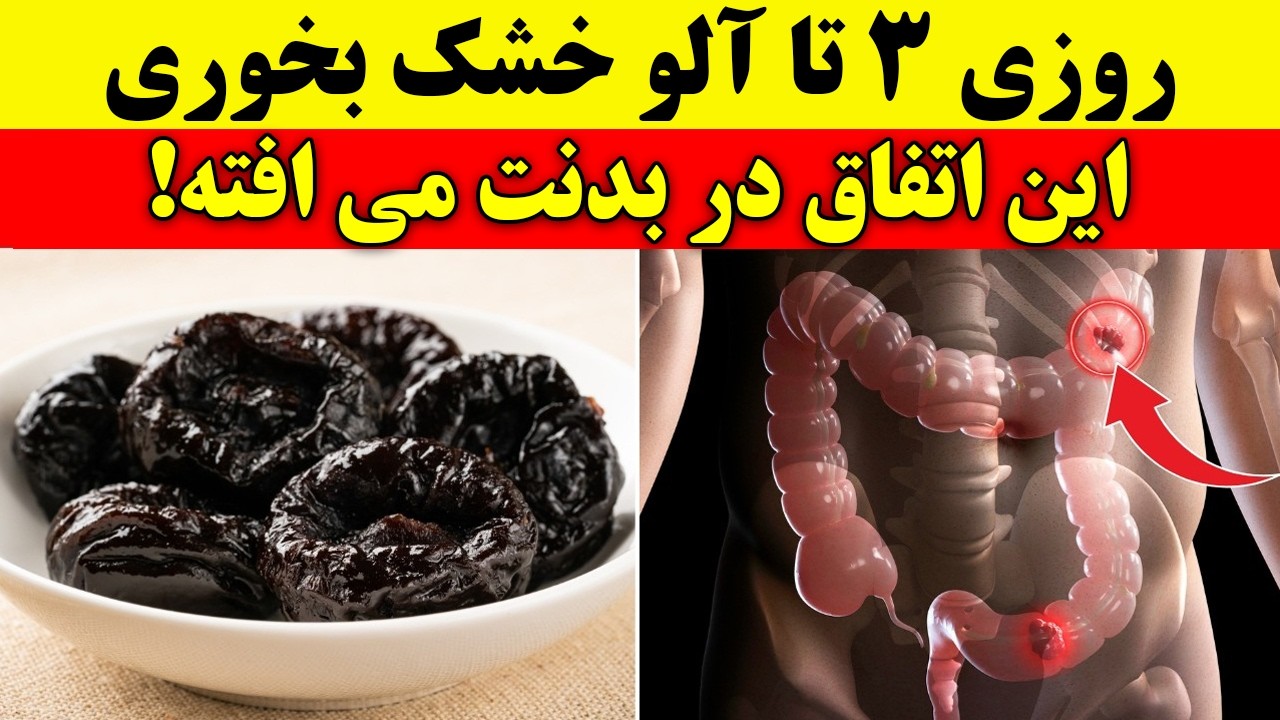 روزی ۳ آلوخشک خوردم… بعد از ۳۰ روز این اتفاق در روده و استخوانم افتاد!