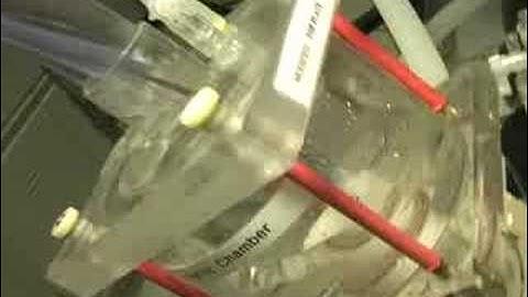 Catheter Deliverable Artificial Aortic Heart Valve