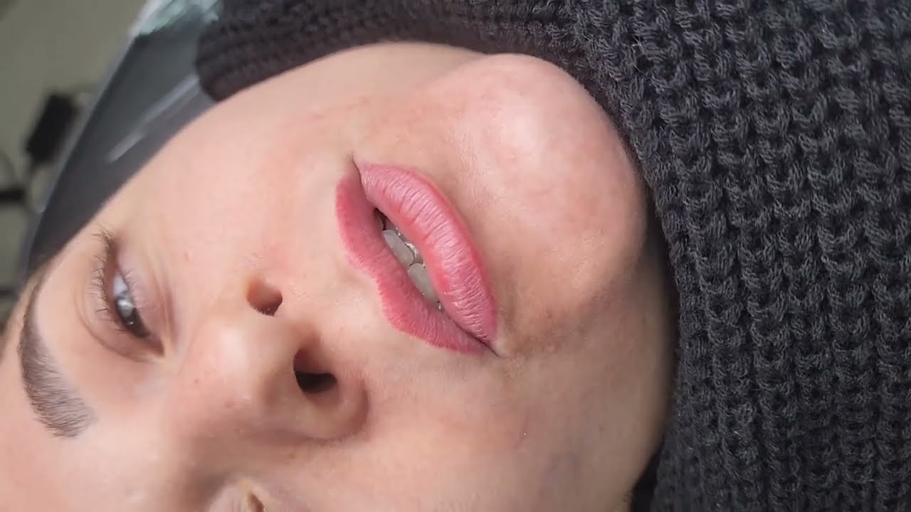 Remoção de micropigmentação nos lábios #pmu #micropigmentação #labial