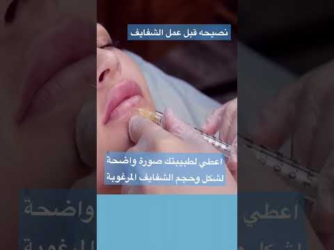 نصيحة قبل عمل شفايفك فيلر شفاة