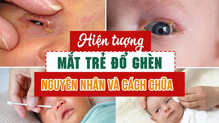 Nguyên nhân gây viêm màng não ở trẻ sơ sinh