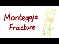 Monteggia Fracture