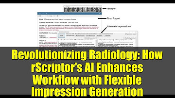 Revolutionizing Radiology: How rScriptor
