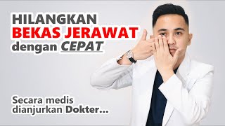 DR. OZ - MENGATASI JERAWAT DAN KANKER PAYUDARA (20/5/2017) Part 1. 