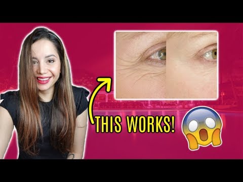 How To Rebuild Collagen Under Eyes *EVIDENCE BASED* (not bone broth)