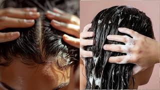 #hairfallsolution #hairfalltreatment #haircareindia#hairfallcontrol #hairgrowthjourney 