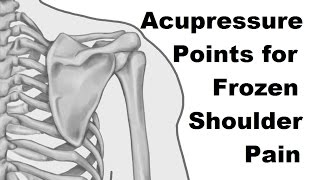 Acupresure Points for Frozen Shoulder Pain - Massage Monday 267