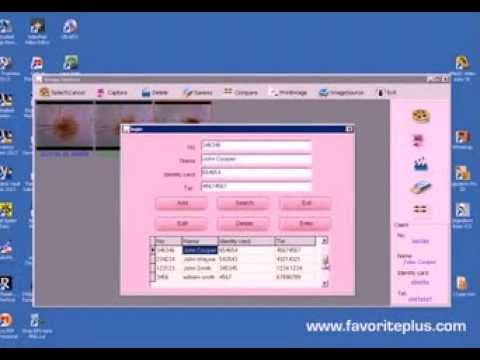 How to Dental USB Software with Intra Oral Camera - YouTube