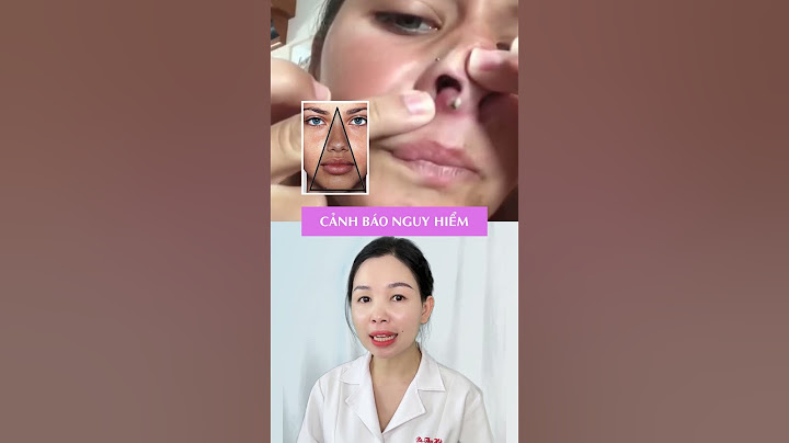 Mụn bọc, cảnh báo nguy hiểm, cách xử lý #shots #bacsithuha