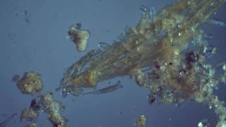 Rotifers (Rotaria / Bdelloid rotifer) oblique lighting under compound microscope @ 40x