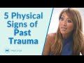 5 Physical Signs of Past Trauma That Most People Miss