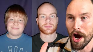 He Aged 15 Years in 3 Minutes - Baldcafe Reacts