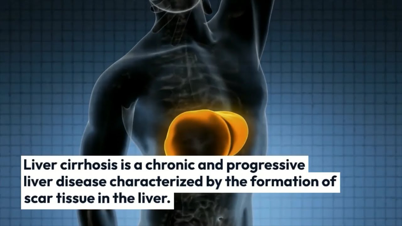 Liver Cirrhosis Treatment Cost In India Liver Cirrhosis Treatment In