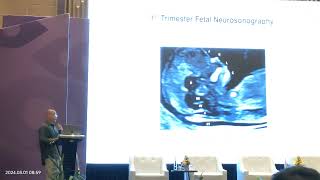 1st TRIMESTER FETAL SONOGRAPHY (Dr. Herman Kristanto SPOG KFM)