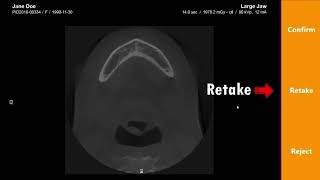 VISION Post Capture & Image Save
