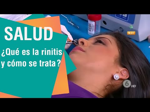 ¿Qué es y cómo se trata la rinitis?