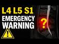 WARNING These Are The 3 MAJOR Symptoms Of A Severe L4 L5 L5 S1 Disc Bulge Dr Walter Salubro WARNING These Are The 3 MAJOR Symptoms Of A Severe L4 L5 L5 S1 Disc Bulge Dr Walter Salubro