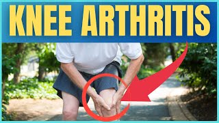 Symptoms, Causes and Treatment of Knee Arthritis