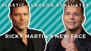 RICKY MARTIN'S NEW FACE: Did Ricky Martin Have Plastic Surgery? Plastic Surgeon Evaluates.