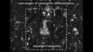 Osteogenic differentiation under Nanolive
