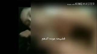 اجمد فضيحة لا مودة الدهم