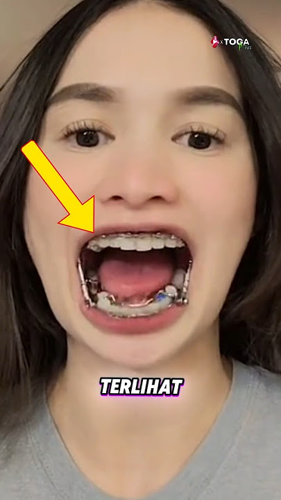 A Suspension-Like Device That Can Correct Your Jaw 😱
