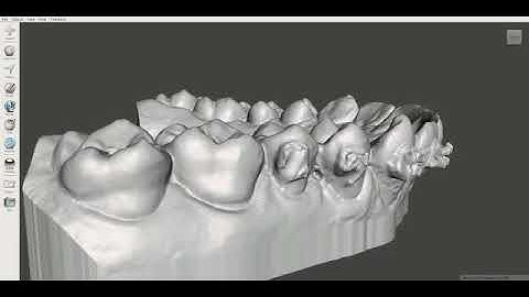 Meshmixer: removing brackets