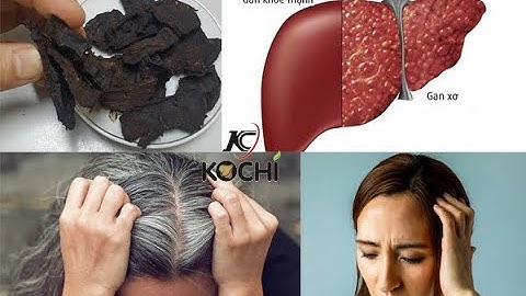 Sự thật tác dụng hà thủ ô đỏ bạn nên biết