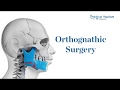 Orthognathic surgery procedure  medical tourism mexico
