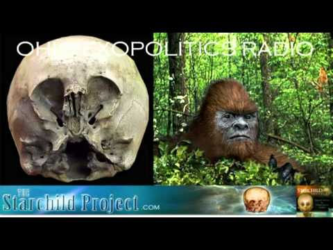 Amy Vickers : Bigfoot , Star Child Skull and Discl...