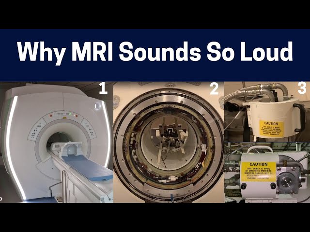 What Makes The Different Sounds In MRI Scans? (From Loud Knocking to Rhythmic Chirping) class=