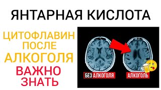 Алкоголь l Янтарная кислота l Поможет? Много специфики