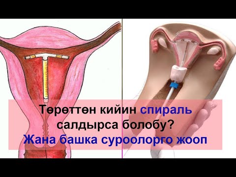 Video: Киндик чубалгысы: себептери жана кесепеттери