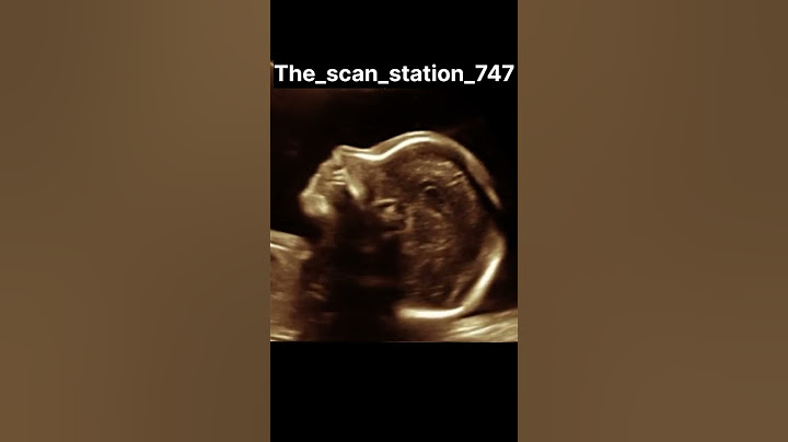 Baby..., #abdomen #baby #babydoctor #pregnant #doctor #pregnancyjourney #ultrasound #ultrasoundscans