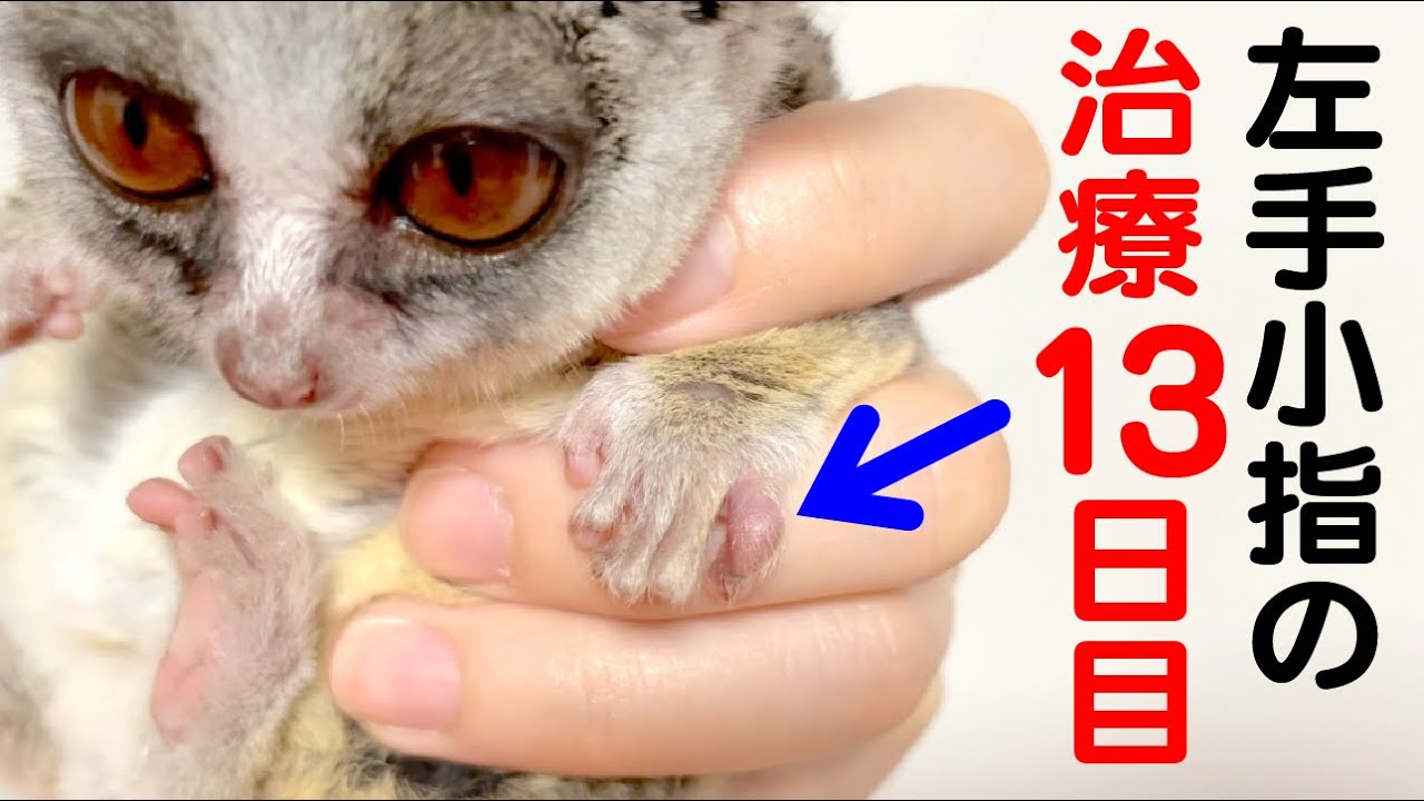 小さなお猿の小指治療13日目 Pizzatoru The Bushbaby ショウガラゴのピザトル Youtube