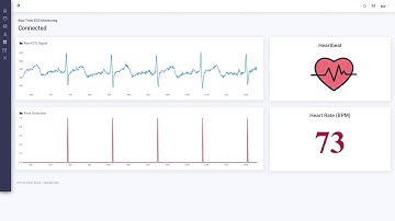 Heartrate Monitoring using Textile based Sensors