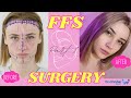 How to not FAIL your Facial Feminization Surgery in Korea Part 1