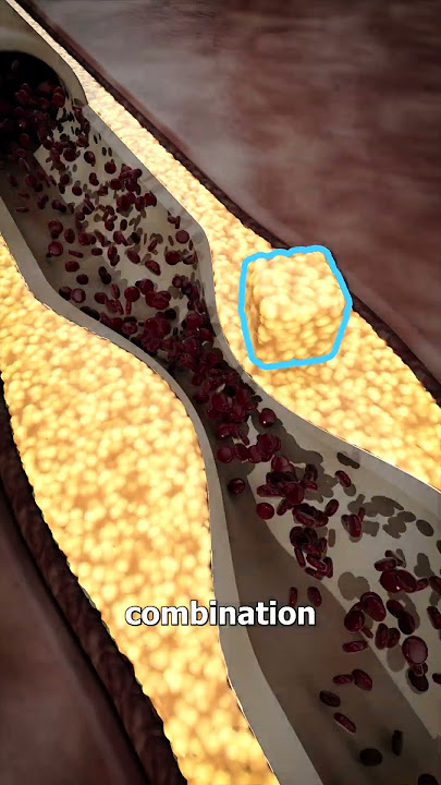 The Biology Of A Heart Attack 🫀