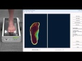 Vorum Products: 3D Plantar Scanner