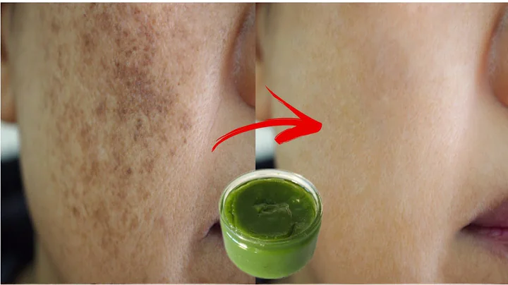 Are you ashamed of wrinkles on your face? Apply th...