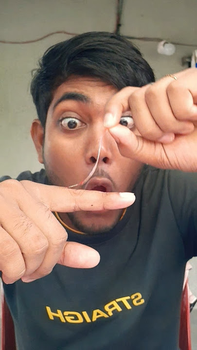Sick hangnail🤯😨🙅 (full version)#shorts