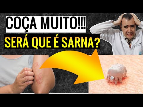 Vídeo: Sarna No Mamilo: Causas E Opções De Tratamento