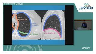 Lung Cancer Screening 2   Practical Implementation Supported by an Independen Medstudylab.com