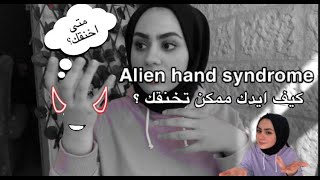 مرض يجبرك على ايذاء نفسك بيدك❗️متلازمة اليد الغريبة Alien hand syndrome ✋🏼