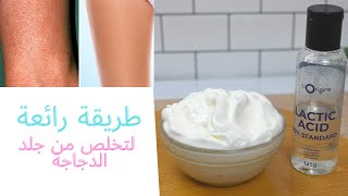 كيف تتخلصين من مشكلة جلد الدجاجة?| و أهم المواد الفعالة لعلاجها