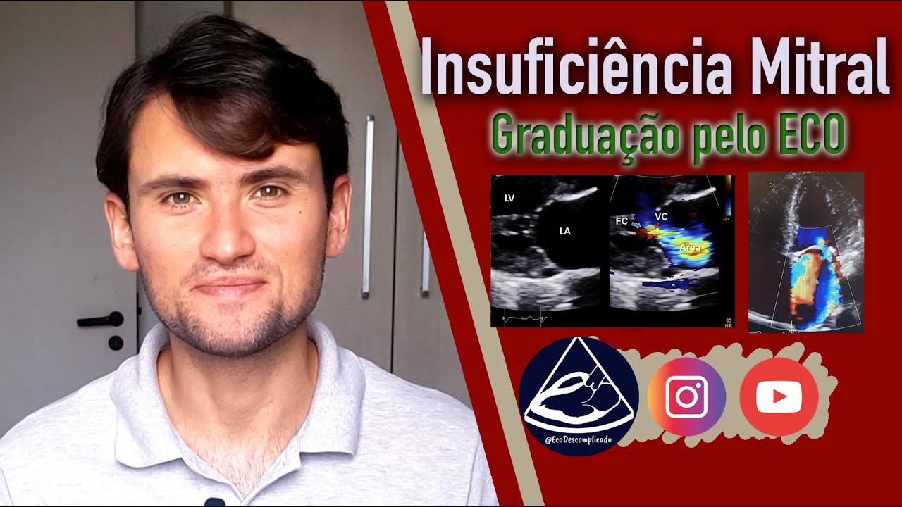 Insuficiência Mitral - Como graduar e quantificar de maneira simples com o Ecocardiograma