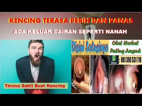 kencing-terasa-perih-dan-panas-ada-keluar-cairan-seperti-nanah