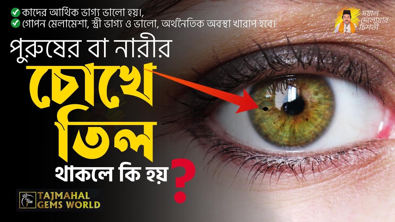 চোখে তিল থাকলে কি হয়? Mole in The Eye Astrology দেহের কোথায় তিল