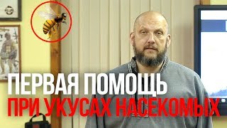 Укусы насекомых | Помощь при укусах насекомых | Алгоритм первой помощи при укусах насекомых